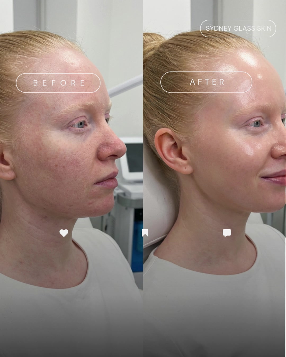 Before After